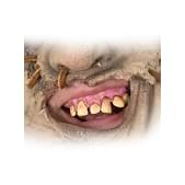 Dientes postizos de Leatherface